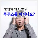 만성적 염증 반응 루푸스를 아시나요 이미지