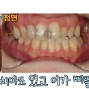 장원치과의원 네이버블로그