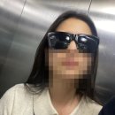 강남 스마일라식 당일 수술 후기(광고 X)(2)