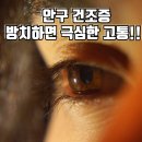 &#34;눈이 너무 아프다면 안구건조증?! 극심한 통증부터 치료까지 완벽 정리!&#34; 이미지