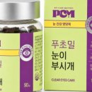 눈이부시개 네이버블로그