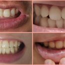 광려중학교 이미지