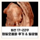정상범 | 임신17주-22주 | 정밀초음파 후기, 운동, 일상들