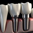 이스턴치과의원 이미지