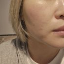 람스네일 - 북구 첨단연신로108번길 128 | 람스킨케어 부천피부관리 후기 여드름 피부 전문 관리받아봤어요