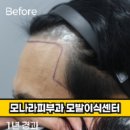 모나라피부과의원 이미지