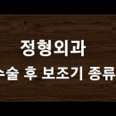 정형외과 수술 후 사용하는 보조기 종류 이미지