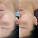 [대구 피부관리] 대구 동구 신천동 고급제품 스킨케어 잎새달뷰티