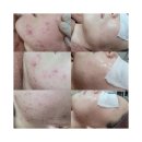 W-232 예신에게 피부란..? 피골탈태 중