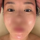 [광주]운암동 해독관리 내돈내산 후기; 헬로스킨앤바디