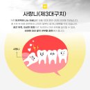 이원치과의원 | 신암동치과 사랑니발치가 필요하다면