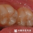 서울이든치과의원 이미지