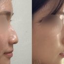 오블리성형외과의원 이미지