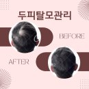 김나연 스킨케어