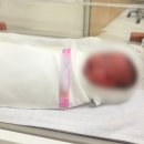 지훈삼겹살 - 11453 | #24. 출산후기_쉬즈메디병원 기록