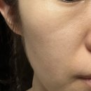 인디언주름 홈케어[홈모드 써마 리프트] 2주차 후기