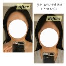 충주공업고 | 헹쇼 뷰티) 충주 예비신부 비대칭 교정, 피부관리 <신혜스킨> 발몽양악관리 추천 후기