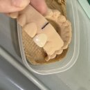 남부치과의원 | 봉천동치과 라미네이트 상담｜그랑교정치과 무삭제 라미네이트 비니어 교정상담 후기