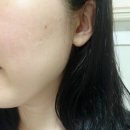 디지털스킨 | 가산디지털단지역 에스테틱 진심스킨케어 웨딩관리 솔직 후기