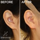 르에이치의원 이미지