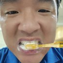 그린e치과기공소 | 계면활성제없는치약 잇몸고민해결 잇생치약 사용 후기