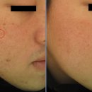 타토아의원 용인점 이미지