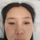 은뷰티 네이버블로그