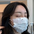 영구있지 | 시흥눈썹문신 반영구 후기