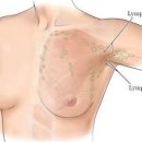 겨드랑이 옆 멍울 통증 원인 이미지