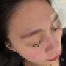 부평차컨설팅 | 내돈내산 인천부평 눈썹문신 잔흔제거 2회차 찐 후기