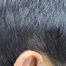 시그니아독일보청기 관악센터 이미지