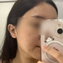 엘츠의원 | 광주엘츠의원 인모드FX 방문 후기