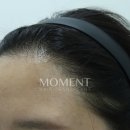 모먼트의원 이미지