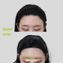 선헤어라인 이미지