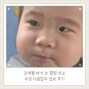 다봄안과의원 | 20개월 아기 눈 찔림 사고 옥정 소아안과 다봄안과 다녀온 후기