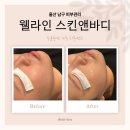 예쁜인스킨케어 | 울산 남구 피부관리 웰라인 스킨앤바디 수분 보충 스페셜케어 후기
