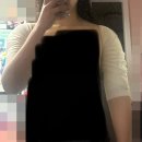 오건 | 팔뚝 지방 추출 회복기｜ 아웃핏 수술 직후~한달 차 후기