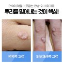 익산뿌리한의원 네이버블로그