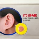 스마일보청기 이미지