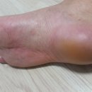 토탈의료기 이미지