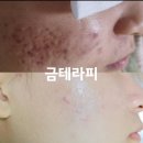 금테라피뷰티샵