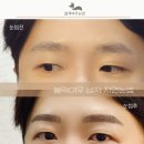 여우눈썹
