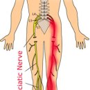 이재규 스포츠 재활 이미지