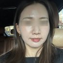 휴사우나 | 수원피부관리실 [휴에스테틱]에서 듀얼토닝 모공축소 받은 후기