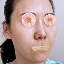 [기능코성형] 예롬성형외과 코성형 1년차 후기입니다
