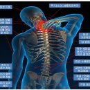 척추/골반/재활[척추 수술/시술 판정 및 재발하신 분... 허리(목) 디스크, 척추 협착증 & 측만증 & 분리증...] & 보디빌딩(Body building) 1:1 맞춤 운동 전문 이미지