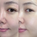 케이아이코스메틱 | 기미앰플 집에서도 케이아이 엑소좀앰플로 모공 기미 잔주름 한달 홈케어 후기