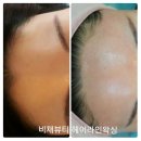 비채라인