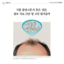 찬스인셀덤