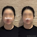 안산윤곽관리 이로에스테틱에서 윤곽라인 정리하고 온 솔직 후기